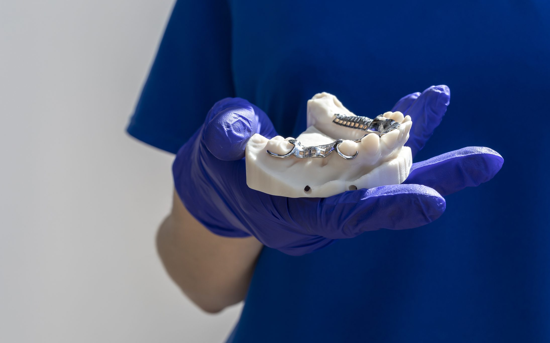 Dental model held with gloved hands.